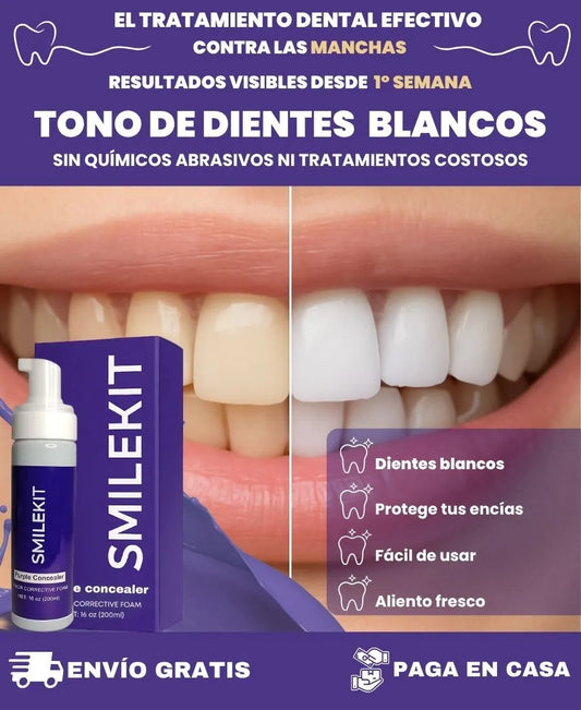 SMILEKIT | Blanquedor dental | Tratamiento efectivo contra las manchas amarilllas de los dientes sin causar sensibilidad